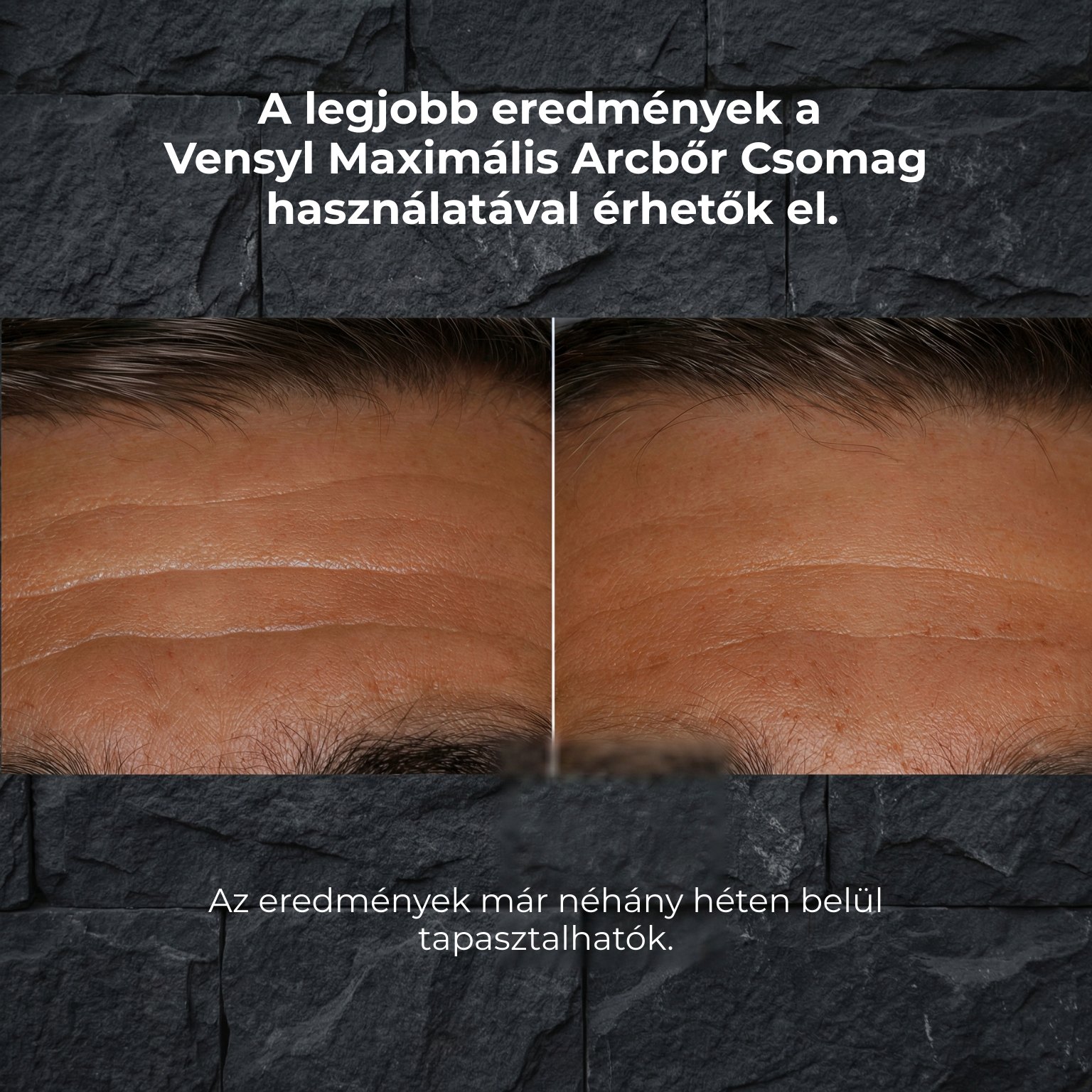 Terra feszesítő arcszérum