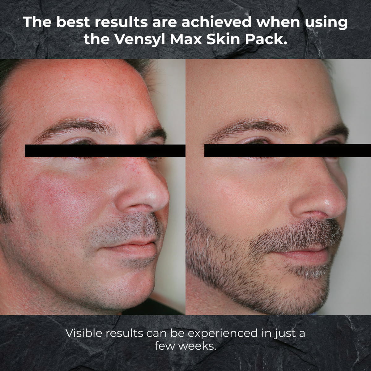 Aurum Instant Moisturizer